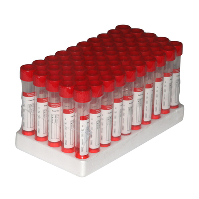 2ml VTM Viral Transport Media Kit Ngừng kích hoạt Không kích hoạt Lấy mẫu