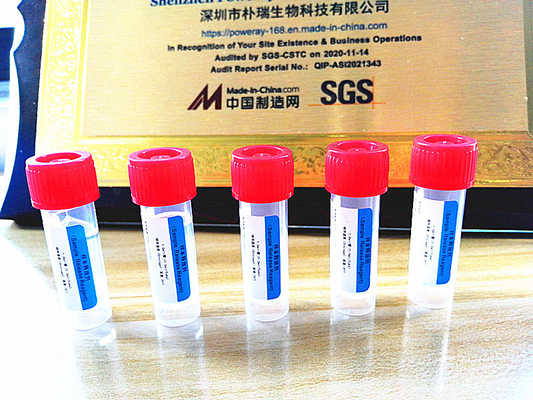 Phê duyệt SGS Bộ xét nghiệm PCR tại nhà Tách chiết DNA và RNA cho Covid-19
